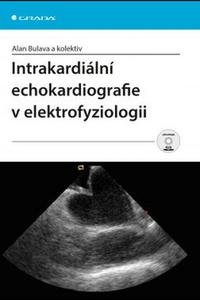 Intrakardiální echokardiografie v elektrofyziologii 