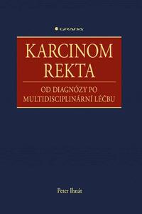 Karcinom rekta