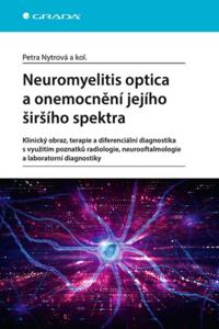 Neuromyelitis optica a poruchy jejího širšího spektra