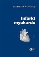 Infarkt myokardu 