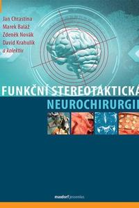 Funkční stereotaktická neurochirurgie