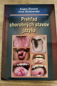 Prehľad chorobných stavov jazyka